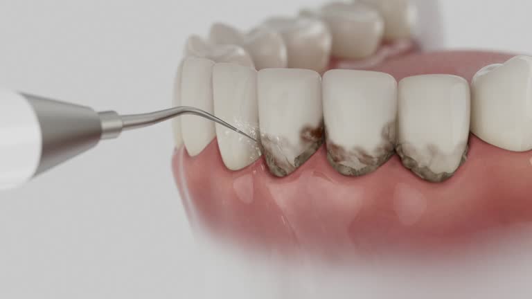 Trusted Tooth Extraction service in Cottageville, SC - Dentist Open Now
